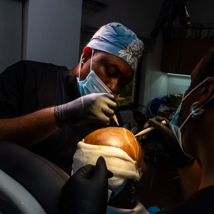 Is hair transplant painful?