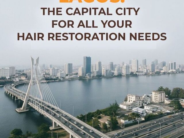 Lagos: The Capital City for All Your Hair Restoration Needs in 2025.