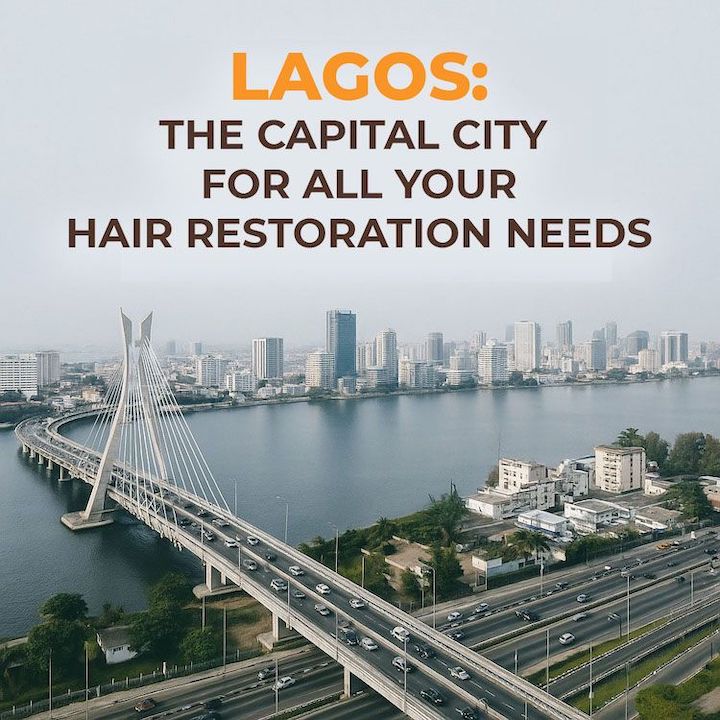 Lagos: the hub city for all hair restoration needs