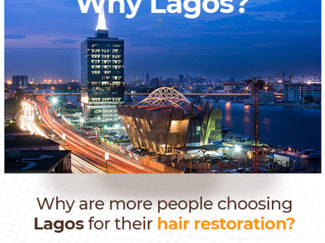 Why Lagos? Why More People Around the World Are Coming to Lagos for Hair Restoration