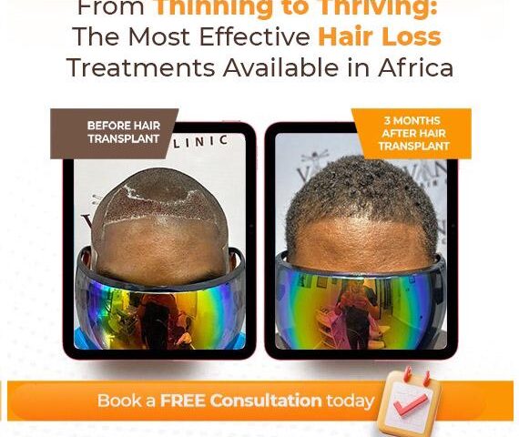 From Thinning to Thriving: The Most Effective Hair Loss Treatments Available in West Africa