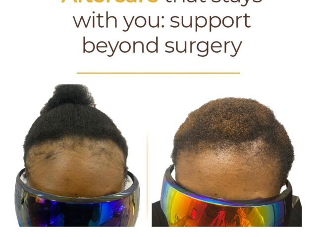 Aftercare That Stays With You: Support Beyond Surgery